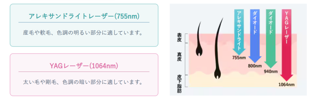 湘南美容クリニック脱毛機「ジェントルマックス プロ」レーザー